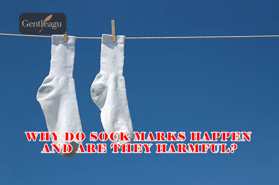 Why Do Sock Marks Happen and Are They Harmful?