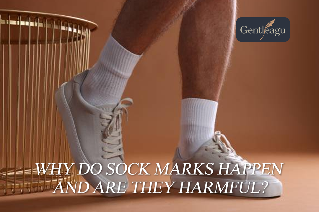 Why Do Sock Marks Happen and Are They Harmful?