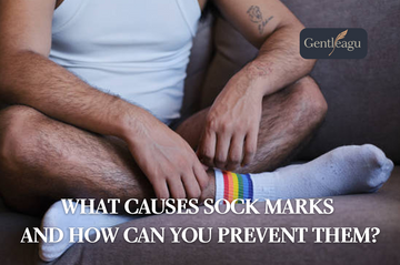 What Causes Sock Marks and How Can You Prevent Them?